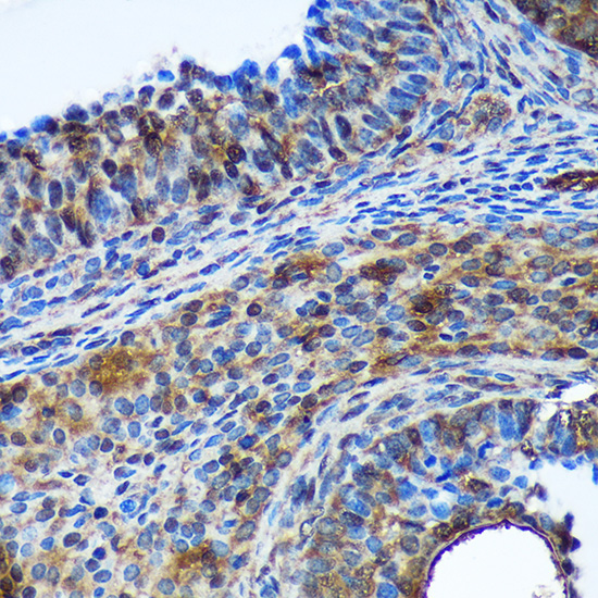 TSN Rabbit polyclonal antibody