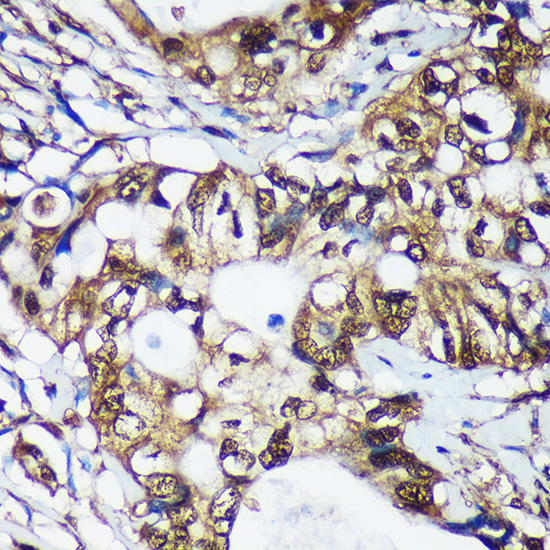 TSN Rabbit polyclonal antibody