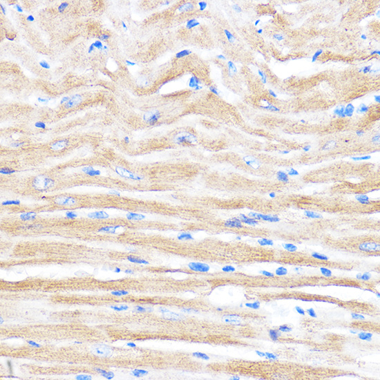 ZMPSTE24 Rabbit polyclonal antibody