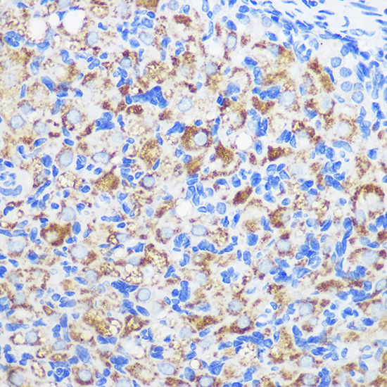 ZMPSTE24 Rabbit polyclonal antibody