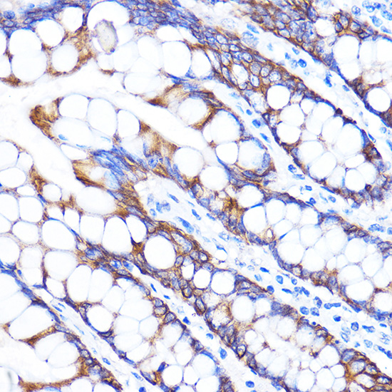 ZMPSTE24 Rabbit polyclonal antibody