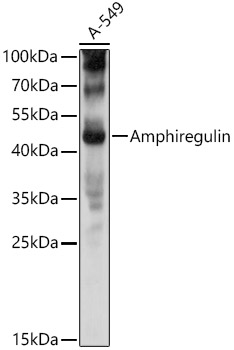 Amphiregulin Rabbit polyclonal antibody