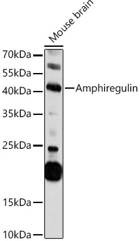 Amphiregulin Rabbit polyclonal antibody
