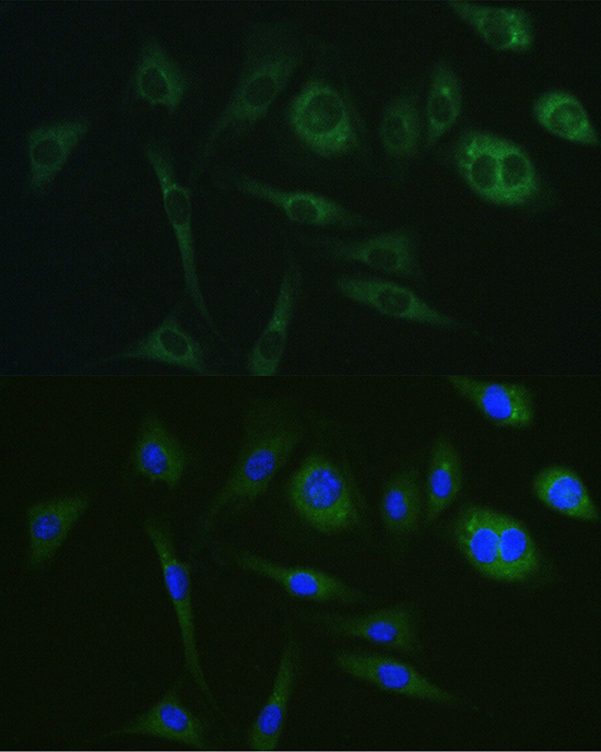 [KD Validated] PKA C-alpha (PRKACA) Mouse monoclonal antibody