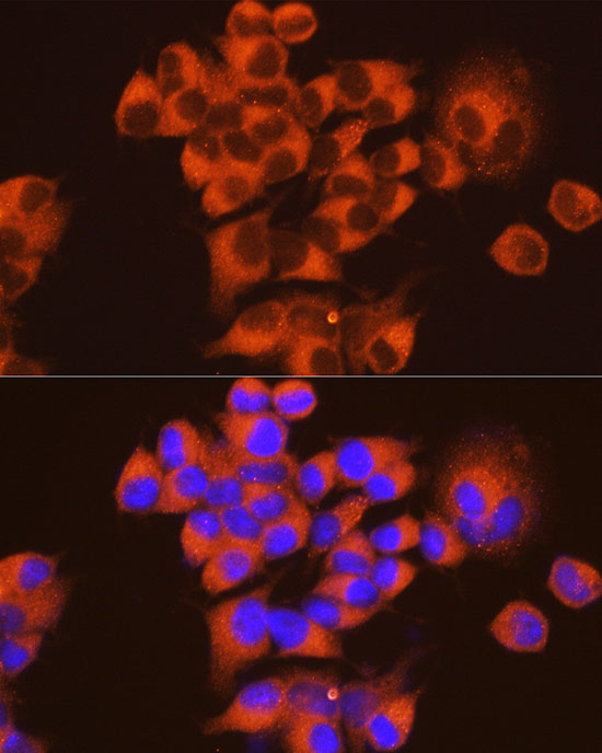 [KD Validated] PKA C-alpha (PRKACA) Mouse monoclonal antibody