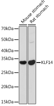KLF14 Rabbit polyclonal antibody