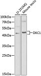 Western blot - DKC1 Rabbit pAb (A1862)