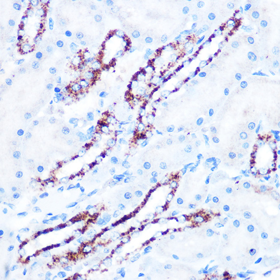 ASB3 Rabbit polyclonal antibody
