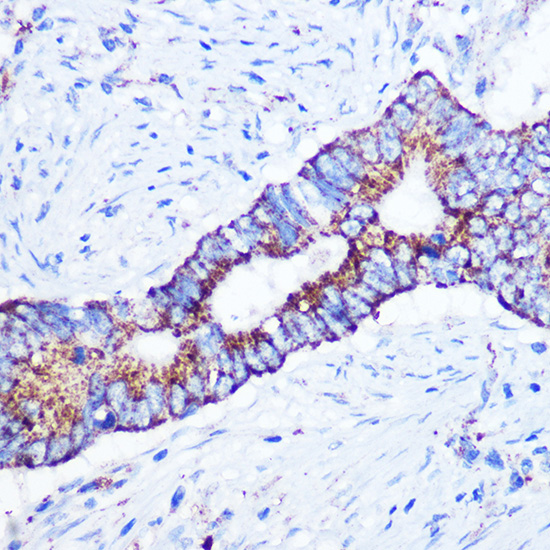 ASB3 Rabbit polyclonal antibody