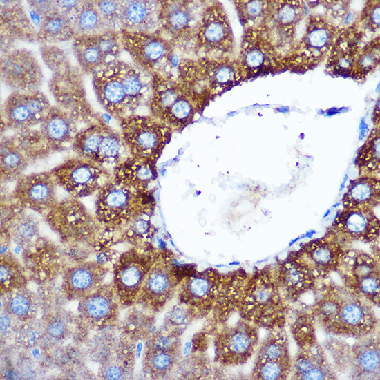 ASB3 Rabbit polyclonal antibody