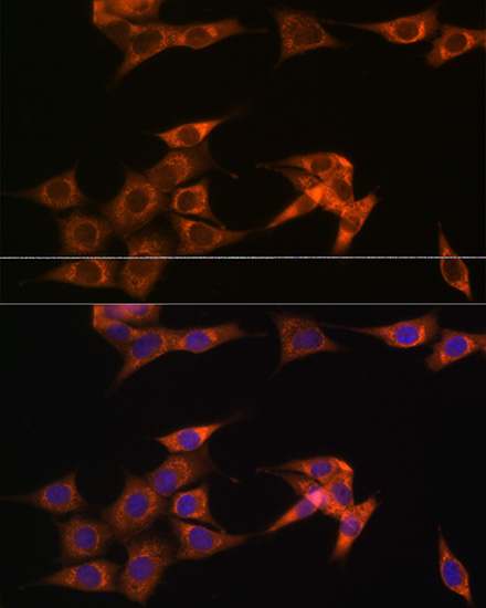 ASB3 Rabbit polyclonal antibody