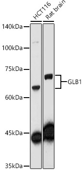 GLB1 Rabbit polyclonal antibody