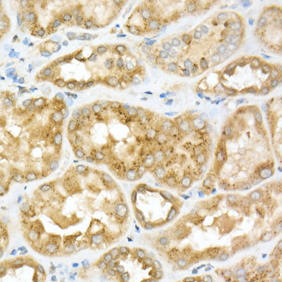 GLB1 Rabbit polyclonal antibody