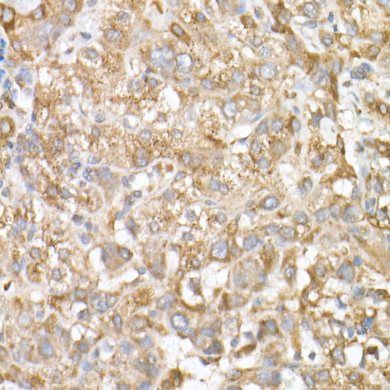 GLB1 Rabbit polyclonal antibody