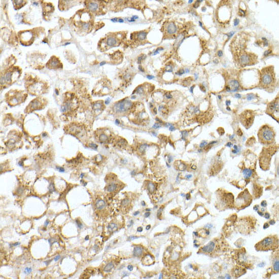 GLB1 Rabbit polyclonal antibody