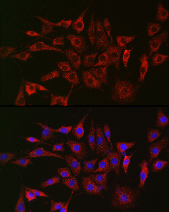 GLB1 Rabbit polyclonal antibody