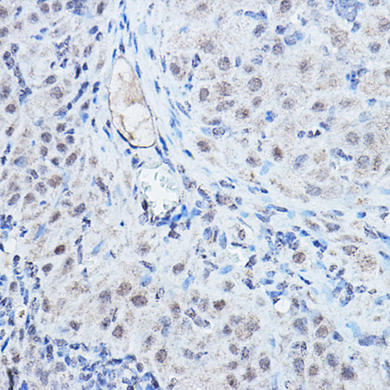 DGCR8 Rabbit polyclonal antibody