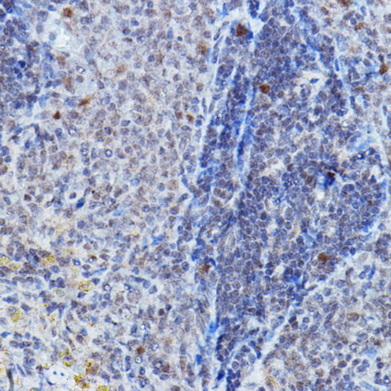 DGCR8 Rabbit polyclonal antibody