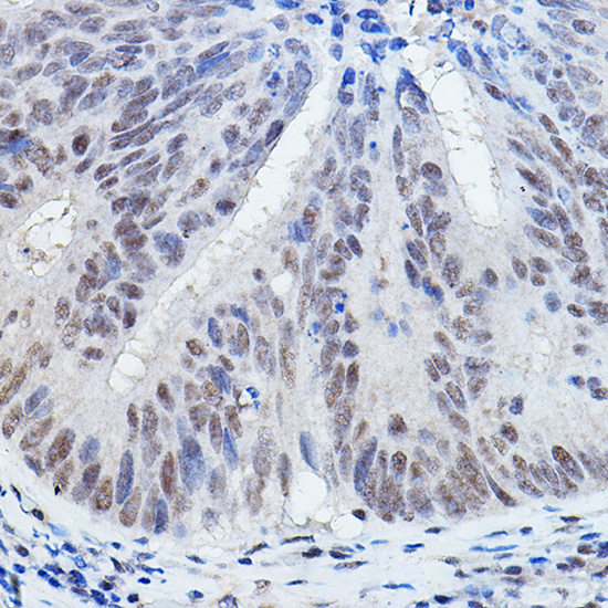 DGCR8 Rabbit polyclonal antibody