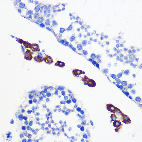 [KO Validated] Bax Rabbit monoclonal antibody