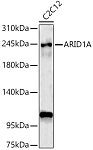 Western blot - ARID1A Rabbit pAb (A18650)