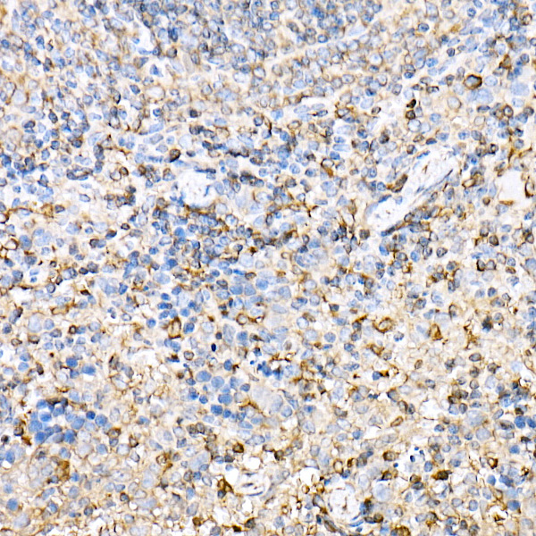 H2-Ab1 Rabbit polyclonal antibody