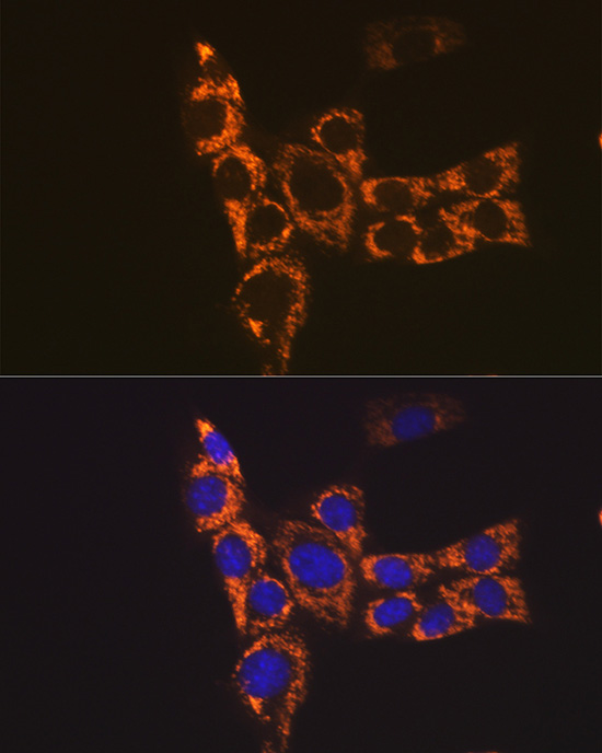 H2-Ab1 Rabbit polyclonal antibody