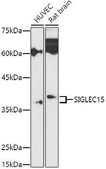 Siglec-15 Rabbit polyclonal antibody