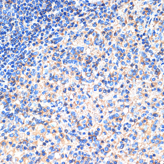 Siglec-15 Rabbit polyclonal antibody