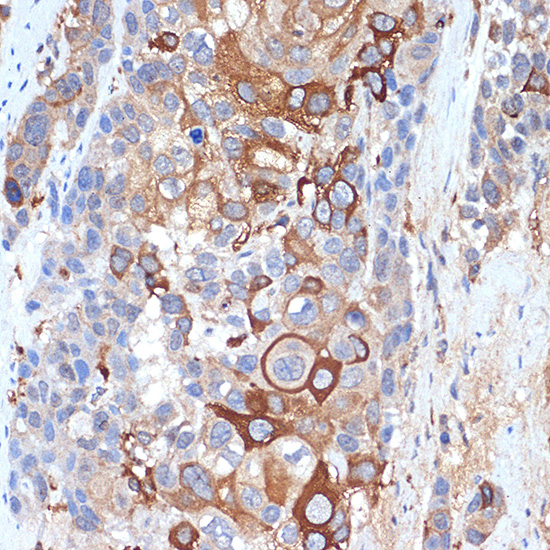 Siglec-15 Rabbit polyclonal antibody