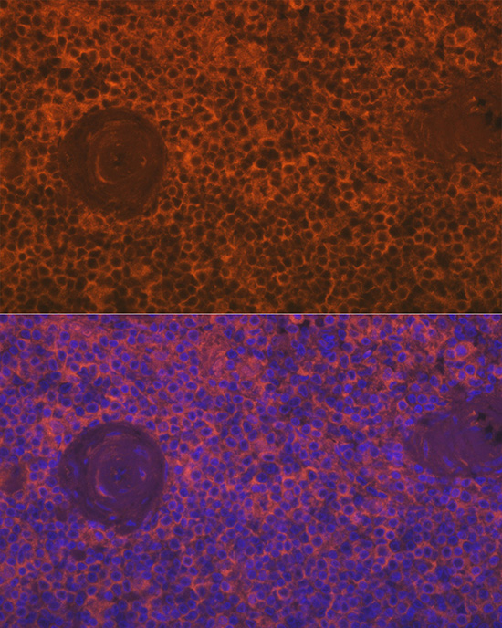 Siglec-15 Rabbit polyclonal antibody