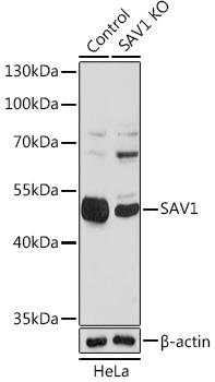[KO Validated] SAV1 Rabbit polyclonal antibody