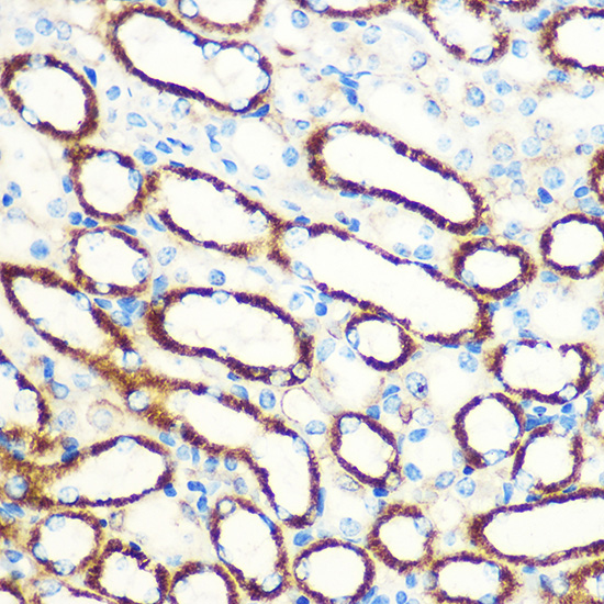 [KO Validated] SAV1 Rabbit polyclonal antibody