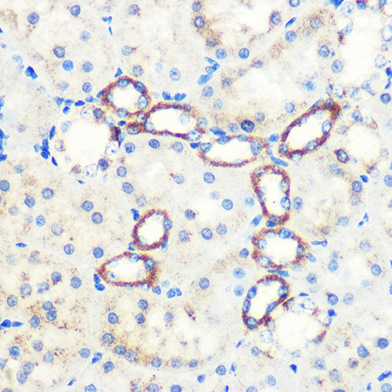 [KO Validated] SAV1 Rabbit polyclonal antibody