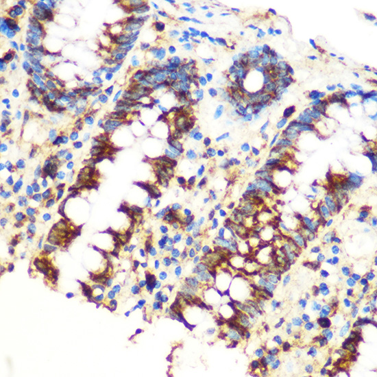 [KO Validated] SAV1 Rabbit polyclonal antibody