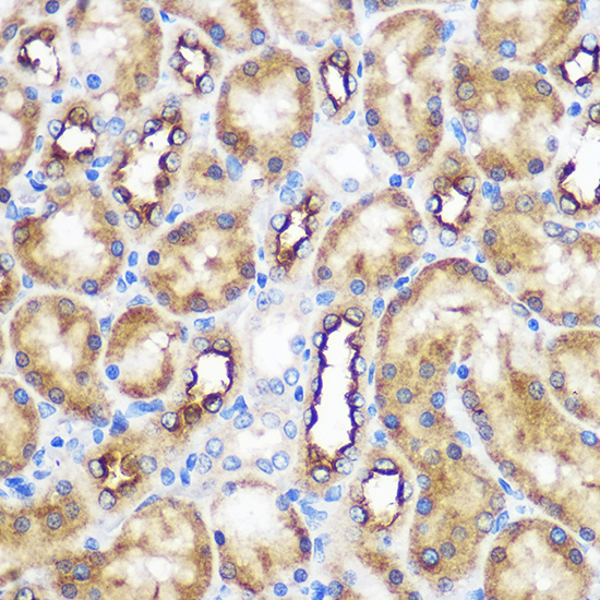 WWC2 Rabbit polyclonal antibody