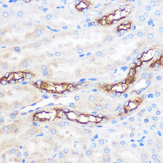 WWC2 Rabbit polyclonal antibody