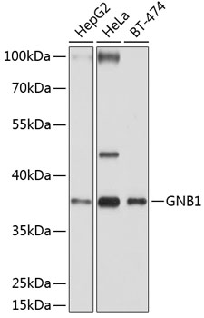 GNB1 Rabbit polyclonal antibody