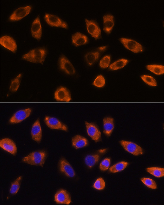 GNB1 Rabbit polyclonal antibody
