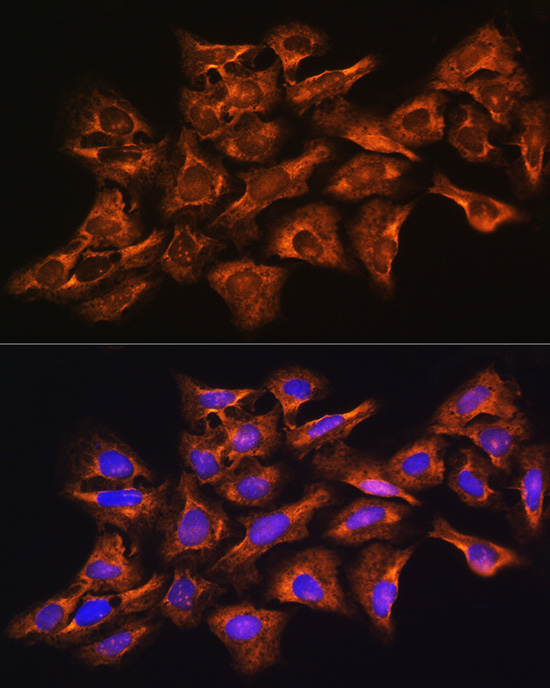 GNB1 Rabbit polyclonal antibody