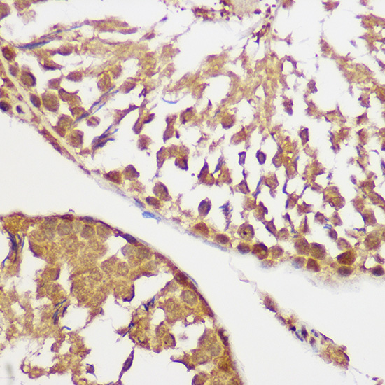 Pan-Akt Rabbit monoclonal antibody