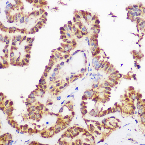 Pan-Akt Rabbit monoclonal antibody