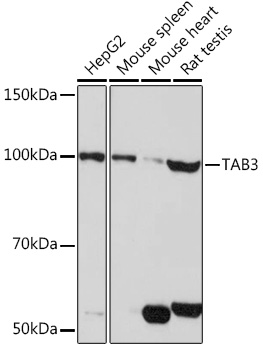TAB3 Rabbit polyclonal antibody