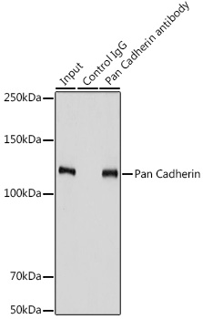 Pan Cadherin Rabbit polyclonal antibody