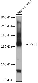 ATP2B1 Rabbit pAb