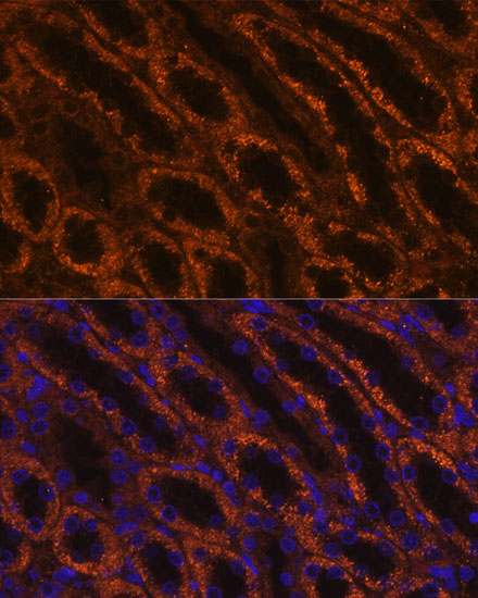 LAMC2 Rabbit polyclonal antibody