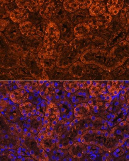 LAMC2 Rabbit polyclonal antibody