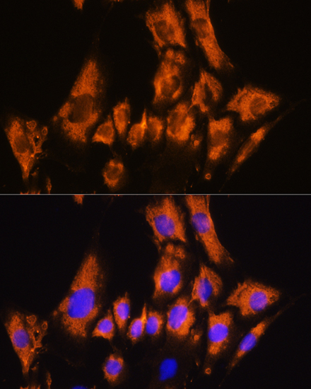 CDH8 Rabbit polyclonal antibody