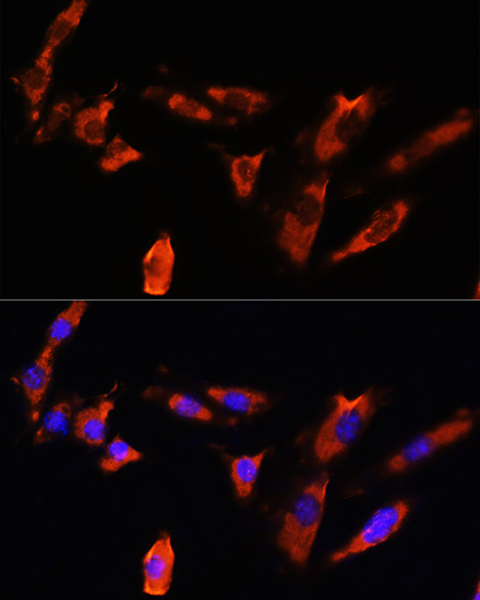 CDH8 Rabbit polyclonal antibody