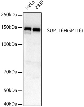 SUPT16H (SPT16) Rabbit polyclonal antibody